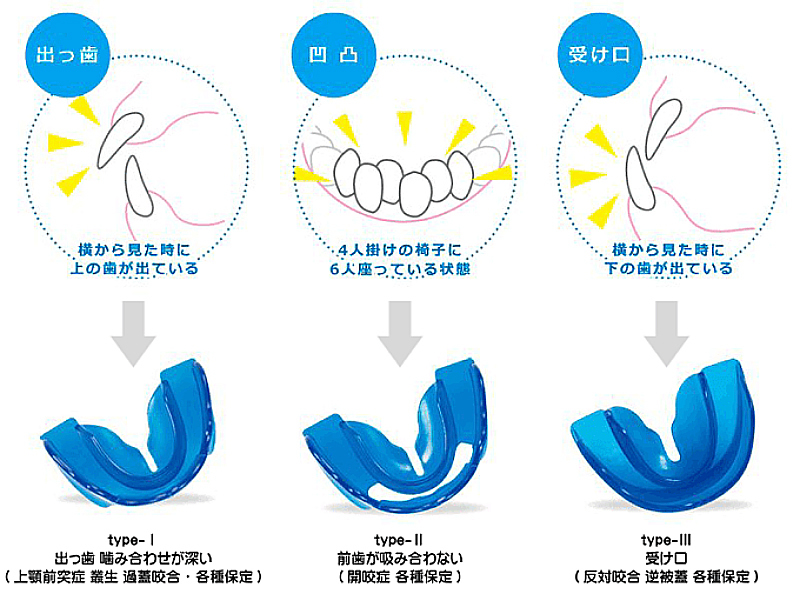 小児矯正・マウスピース矯正 | あじおか歯科クリニック